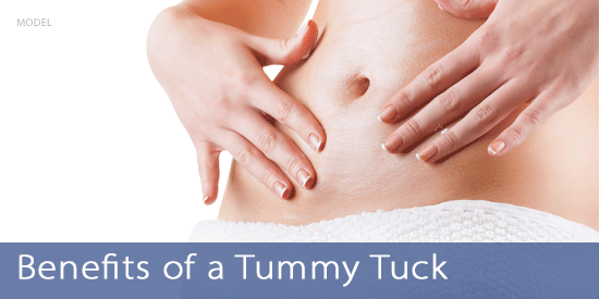benefits of tummy tuck