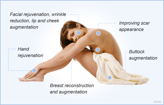 diagram of fat grafting uses